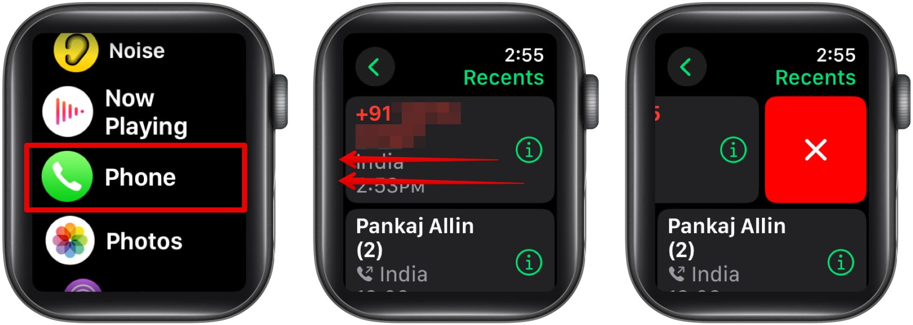 Deleting a recent call in the Phone app on an Apple Watch.