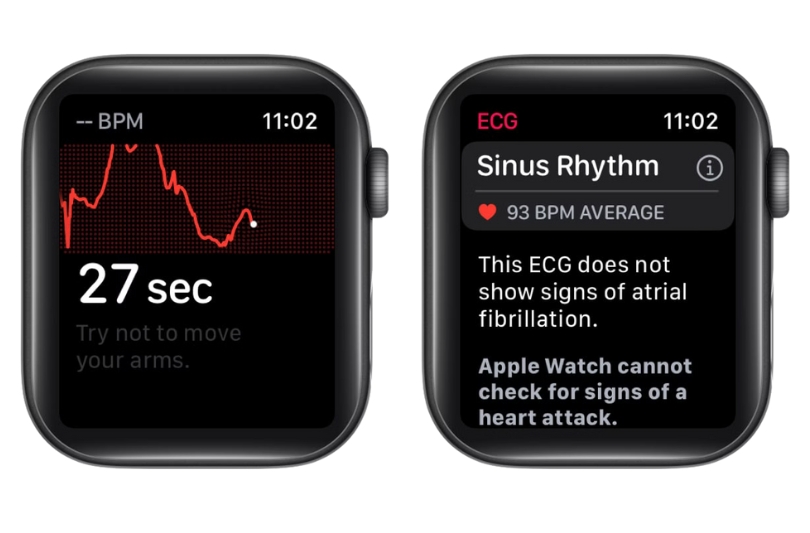 How to Take ECG Reading on Apple Watch – iGeeksBlog Once-countdown-finishes-review-your-results-on-Apple-Watch