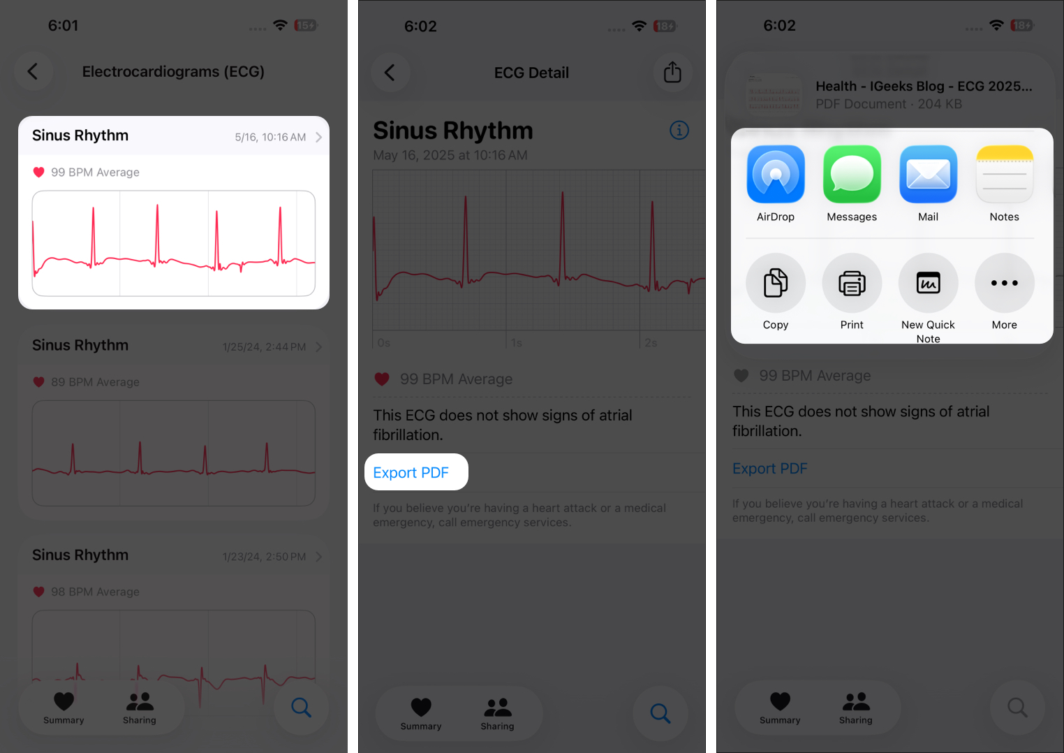 How to Take ECG Reading on Apple Watch – iGeeksBlog Open Health, go to Heart > Electrocardiograms, select a reading, and tap Export a PDF.