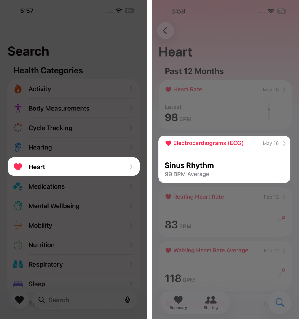 How to Take ECG Reading on Apple Watch – iGeeksBlog Open Health, tap Search > Heart > Electrocardiograms (ECG), and follow the setup instructions