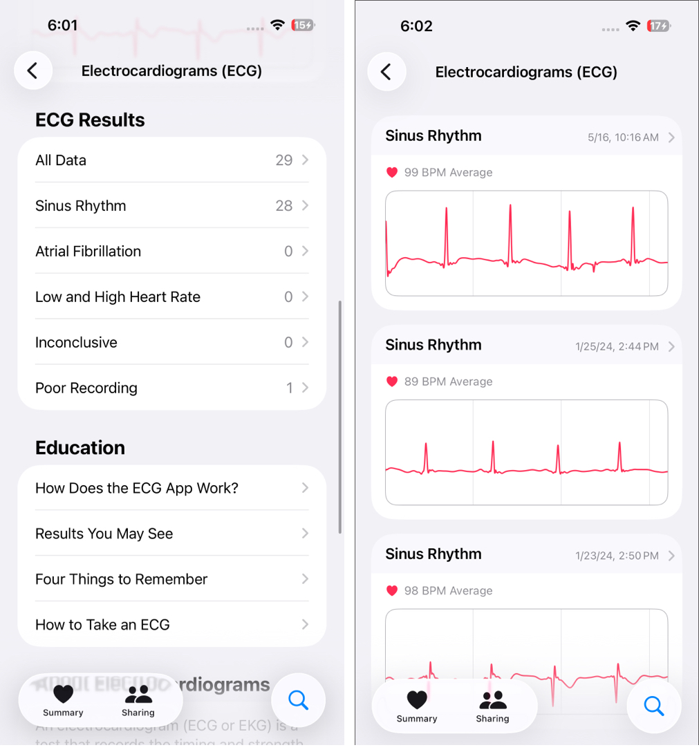 How to Take ECG Reading on Apple Watch – iGeeksBlog Understanding Apple Watch ECG Results and What They Mean